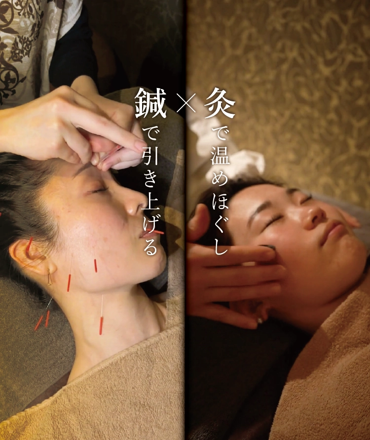 美容鍼と全身鍼灸による究極のエイジングケア ｜ 美容鍼灸コース